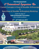 Knee Replacement India